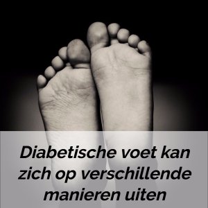 diabetische voeten