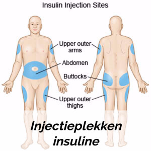 injectieplekken insuline