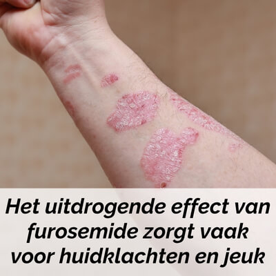 uitdroging bijwerking furosemide uitdroging als bijwerking van furosemide