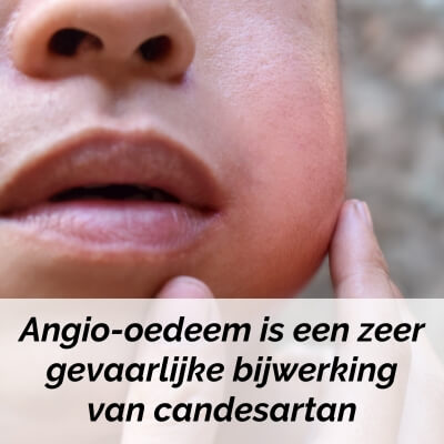 candesartan bijwerking angio-oedeem