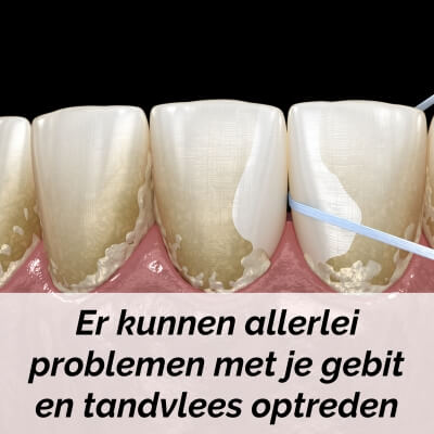bijwerkingen van verapamil gebit bijwerkingen van verapamil gebit